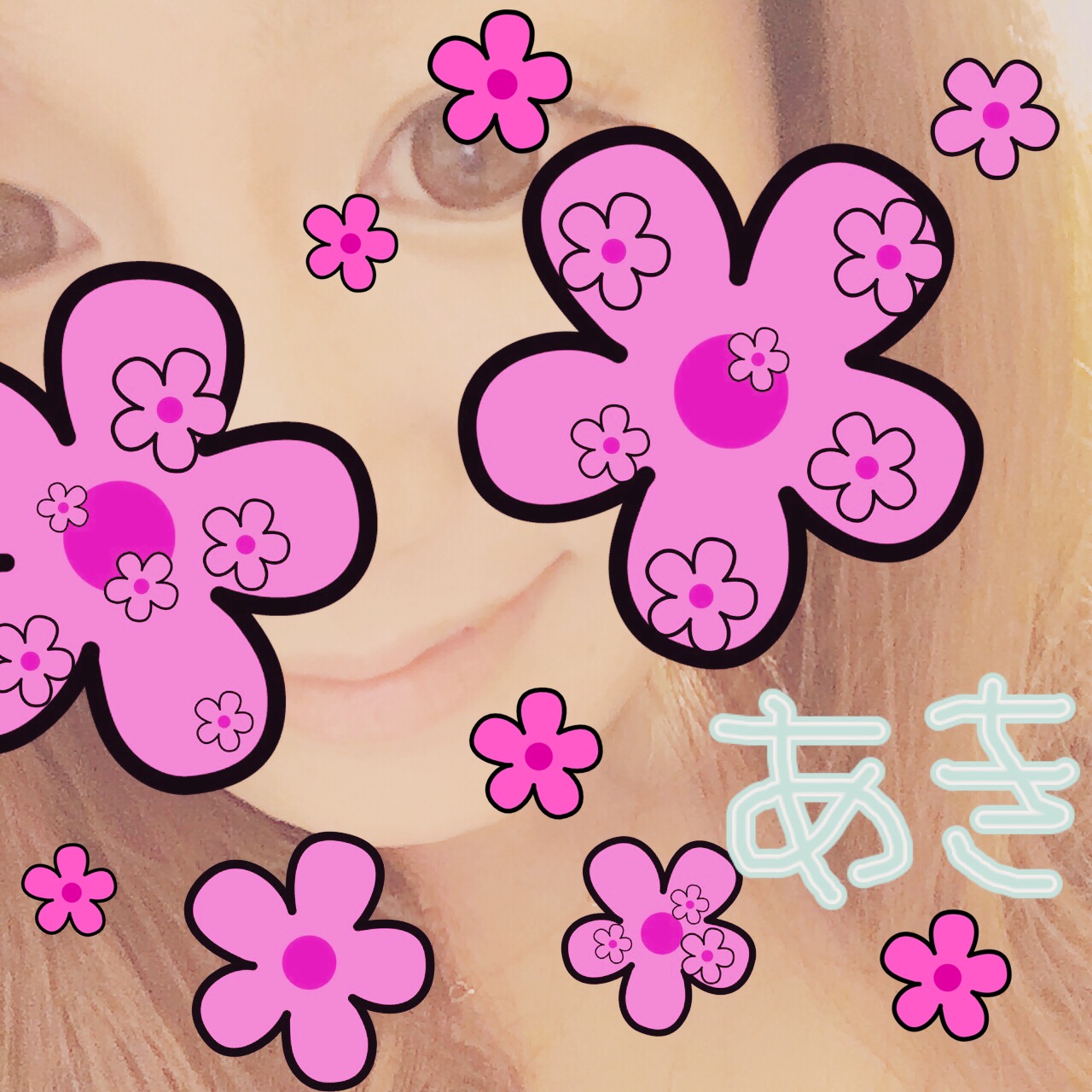 �ꃖ���U��ɏo�΂���[��